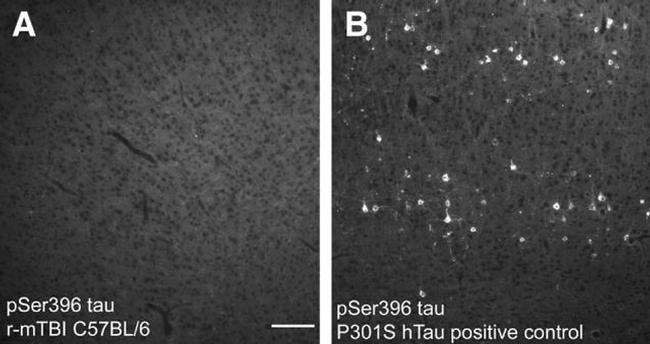 Phospho-Tau (Ser396) Antibody in Immunohistochemistry (IHC)