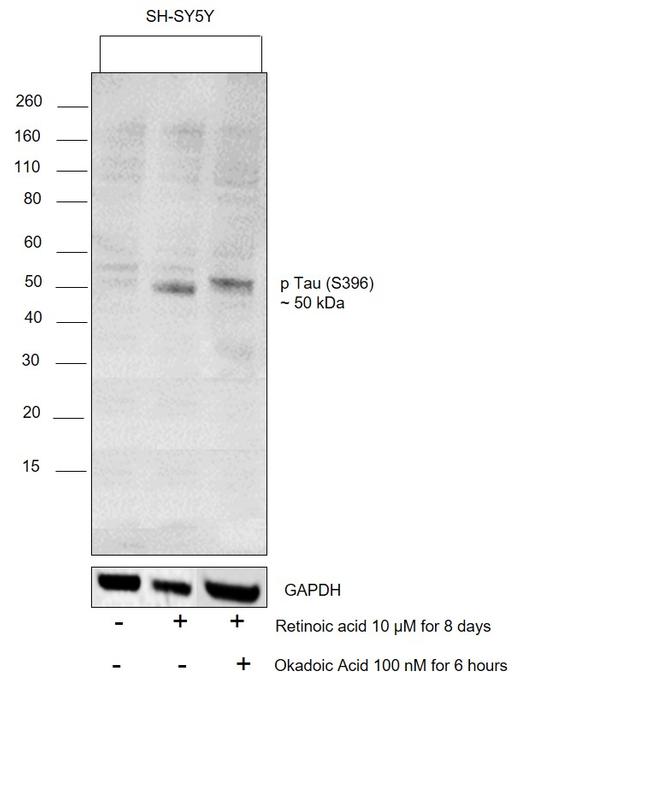 Phospho-Tau (Ser396) Antibody in Western Blot (WB)