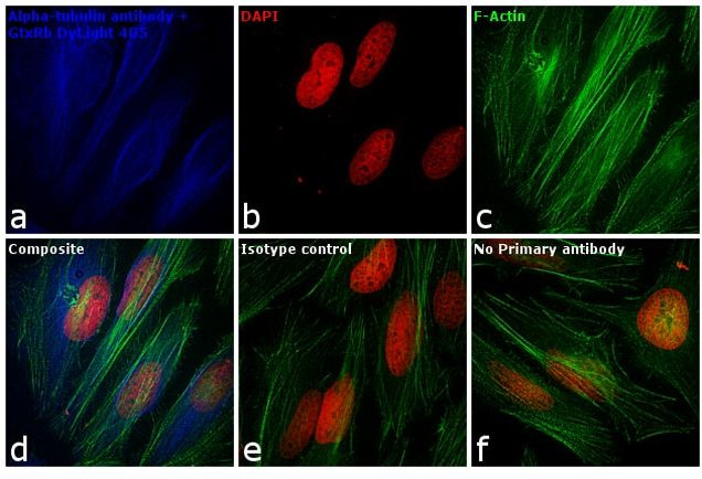 Rabbit IgG (H+L) Cross-Adsorbed Secondary Antibody in Immunocytochemistry (ICC/IF)