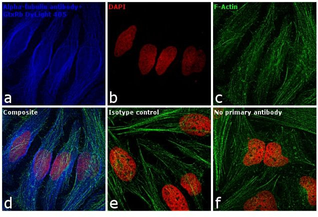 Rabbit IgG (H+L) Secondary Antibody in Immunocytochemistry (ICC/IF)