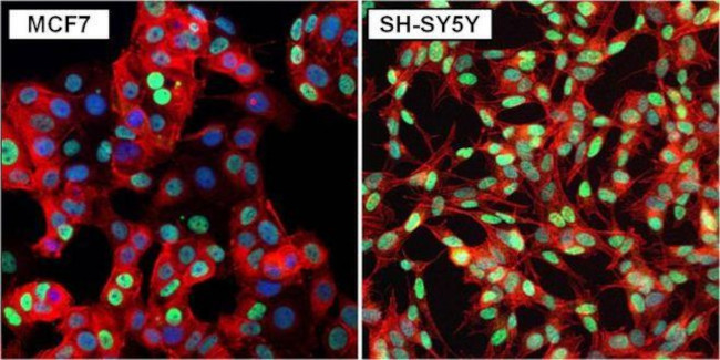 Rabbit IgG (H+L) Secondary Antibody in Immunocytochemistry (ICC/IF)