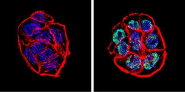 Rabbit IgG (H+L) Secondary Antibody in Immunocytochemistry (ICC/IF)