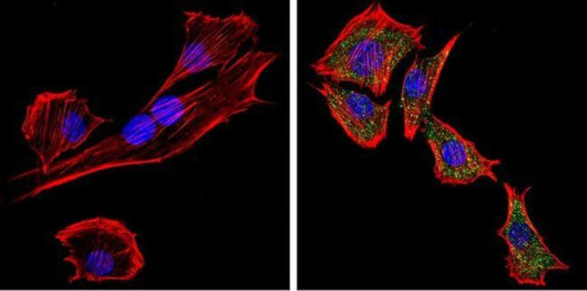 Rabbit IgG (H+L) Secondary Antibody in Immunocytochemistry (ICC/IF)