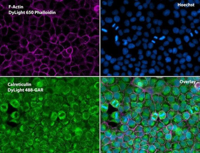 Rabbit IgG (H+L) Secondary Antibody in Immunocytochemistry (ICC/IF)