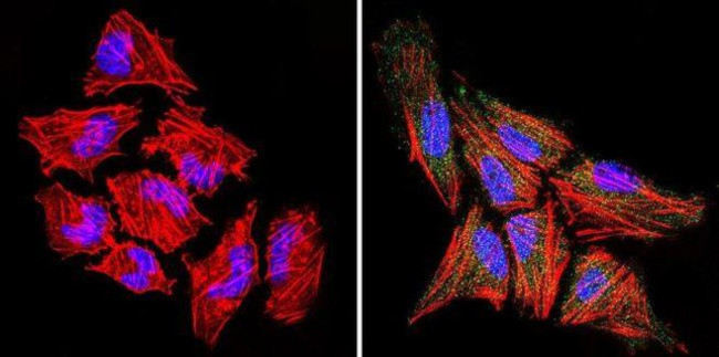 Rabbit IgG (H+L) Secondary Antibody in Immunocytochemistry (ICC/IF)