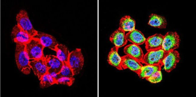 Rabbit IgG (H+L) Secondary Antibody in Immunocytochemistry (ICC/IF)