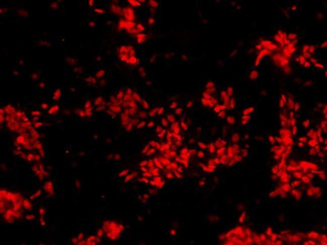 Rabbit IgG (H+L) Secondary Antibody in Immunocytochemistry (ICC/IF)