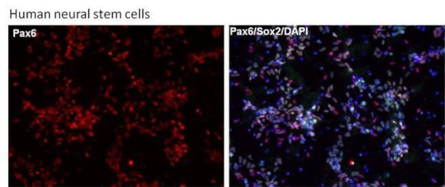 Rabbit IgG (H+L) Cross-Adsorbed Secondary Antibody in Immunocytochemistry (ICC/IF)