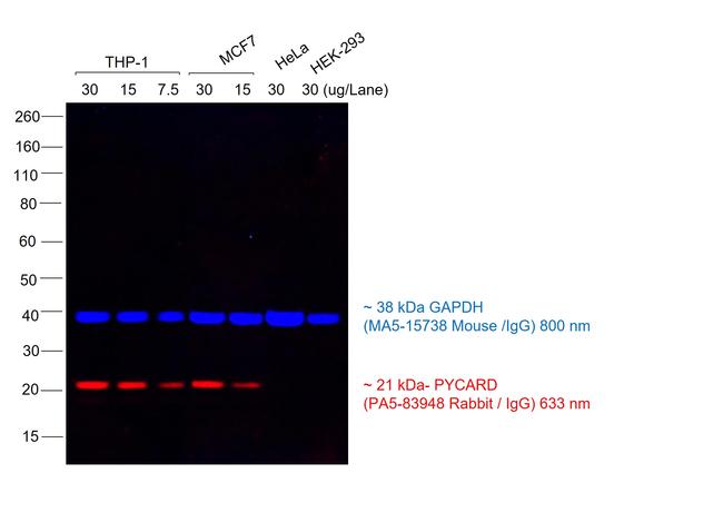 Rabbit IgG (H+L) Cross-Adsorbed Secondary Antibody in Western Blot (WB)