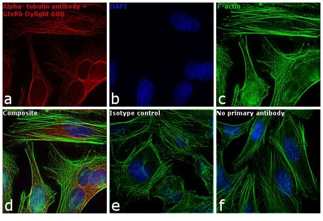 Rabbit IgG (H+L) Secondary Antibody in Immunocytochemistry (ICC/IF)