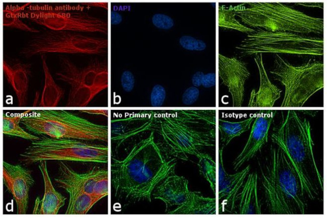 Rabbit IgG (H+L) Secondary Antibody in Immunocytochemistry (ICC/IF)