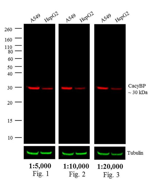 Rabbit IgG (H+L) Secondary Antibody in Western Blot (WB)