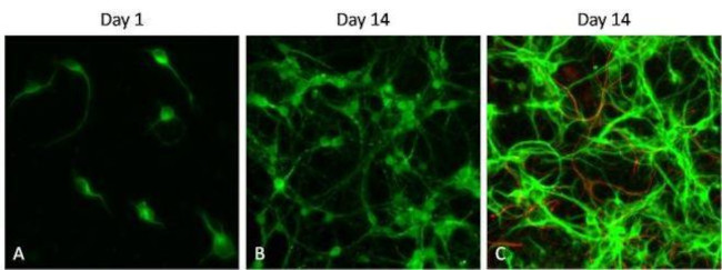 Rabbit IgG (H+L) Secondary Antibody in Immunocytochemistry (ICC/IF)