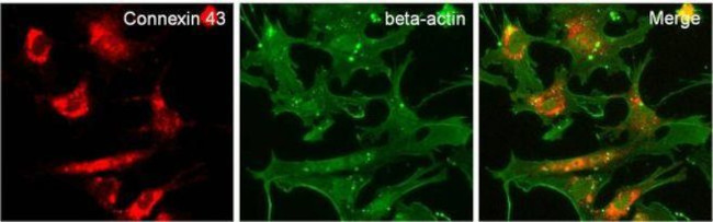 Rabbit IgG (H+L) Secondary Antibody in Immunocytochemistry (ICC/IF)