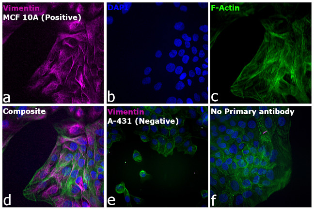 Rabbit IgG (H+L) Cross-Adsorbed Secondary Antibody in Immunocytochemistry (ICC/IF)