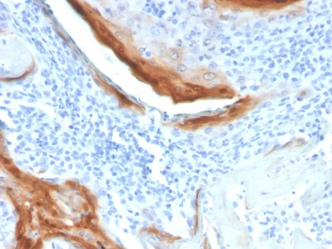 IL1RN/IL-1RN/IL1RA (Interleukin-1RA) Antibody in Immunohistochemistry (Paraffin) (IHC (P))