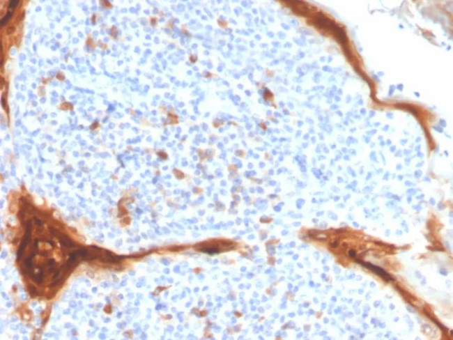 IL1RN/IL-1RN/IL1RA (Interleukin-1RA) Antibody in Immunohistochemistry (Paraffin) (IHC (P))