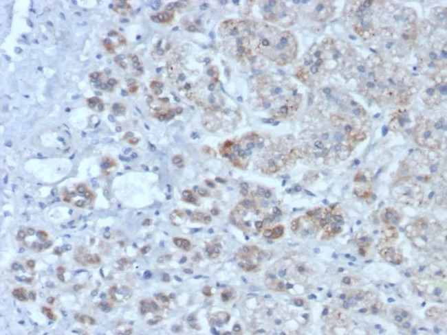 IL1RN/IL-1RN/IL1RA (Interleukin-1RA) Antibody in Immunohistochemistry (Paraffin) (IHC (P))