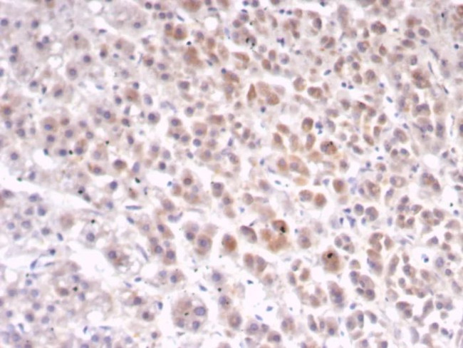 IL1RN/IL-1RN/IL1RA (Interleukin-1RA) Antibody in Immunohistochemistry (Paraffin) (IHC (P))