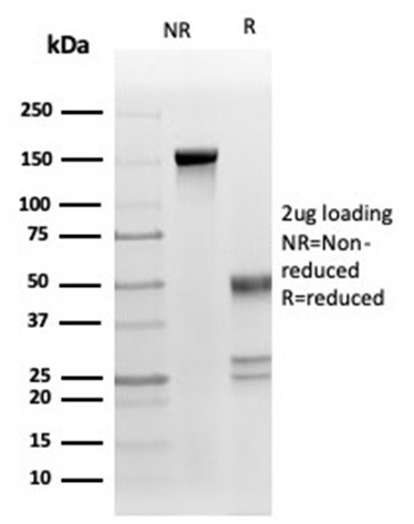 Fas Ligand (FASLG) Antibody in SDS-PAGE (SDS-PAGE)