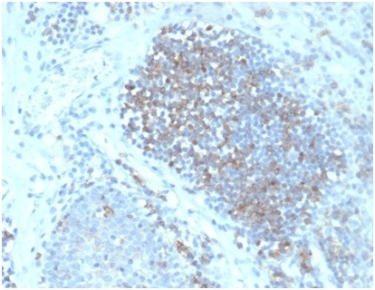 Fas Ligand (FASLG) Antibody in Immunohistochemistry (Paraffin) (IHC (P))