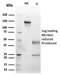 Fas Ligand (FASLG) Antibody in SDS-PAGE (SDS-PAGE)