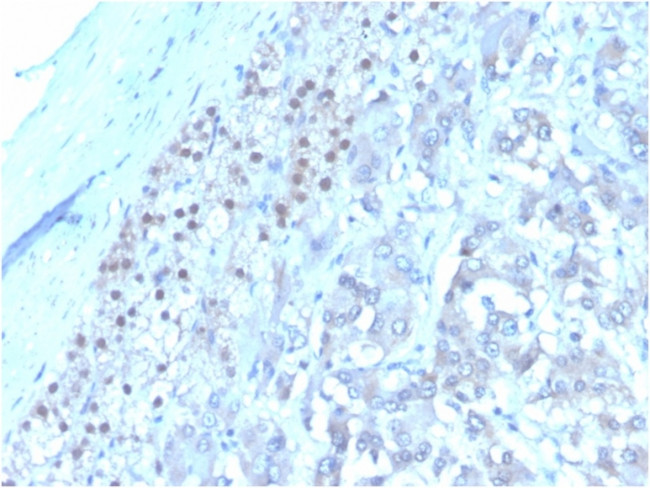 Interleukin-3 (IL-3) Antibody in Immunohistochemistry (Paraffin) (IHC (P))