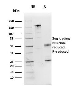 Interleukin-3 (IL-3) Antibody in SDS-PAGE (SDS-PAGE)