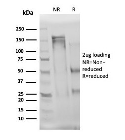 Interleukin-3 (IL-3) Antibody in SDS-PAGE (SDS-PAGE)