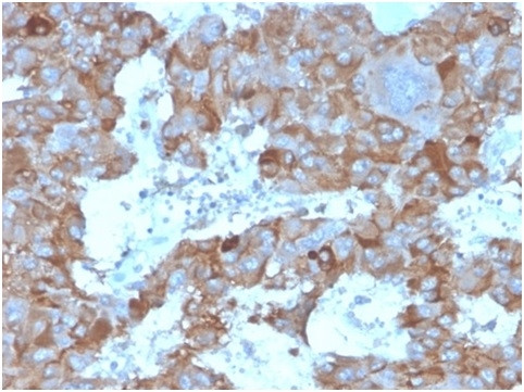 Interleukin-3 (IL-3) Antibody in Immunohistochemistry (Paraffin) (IHC (P))