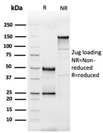 Interleukin-3 (IL-3) Antibody in SDS-PAGE (SDS-PAGE)