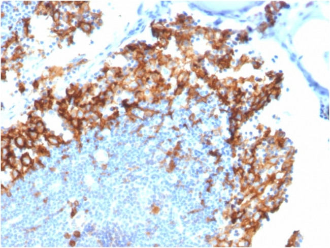 IL3RA/CD123 Antibody in Immunohistochemistry (Paraffin) (IHC (P))