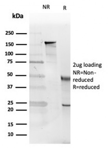 Interleukin-5 (IL-5) Antibody in SDS-PAGE (SDS-PAGE)