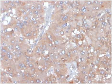 Interleukin-5 (IL-5) Antibody in Immunohistochemistry (Paraffin) (IHC (P))