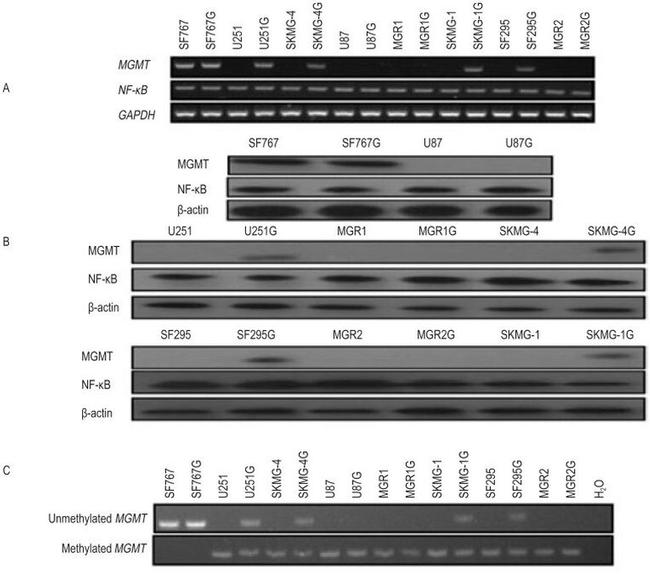 MGMT Antibody in Western Blot (WB)