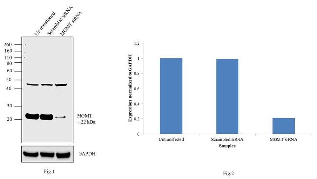 MGMT Antibody in Western Blot (WB)