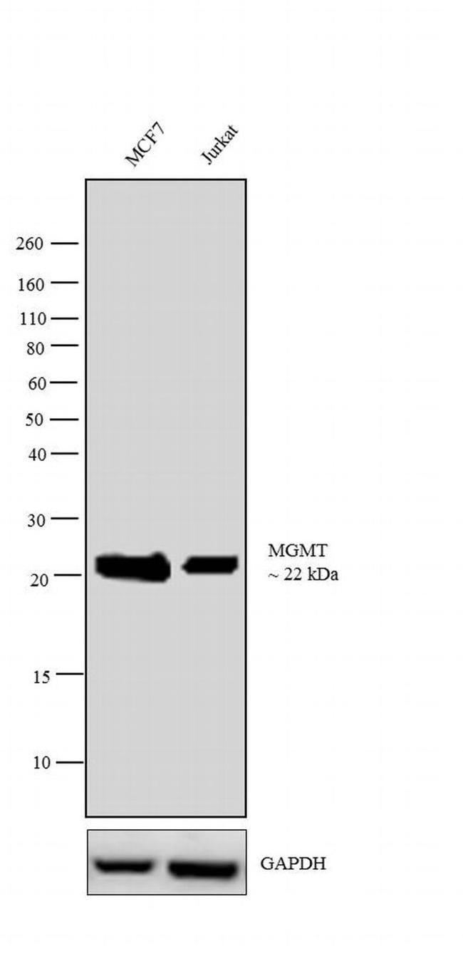 MGMT Antibody in Western Blot (WB)