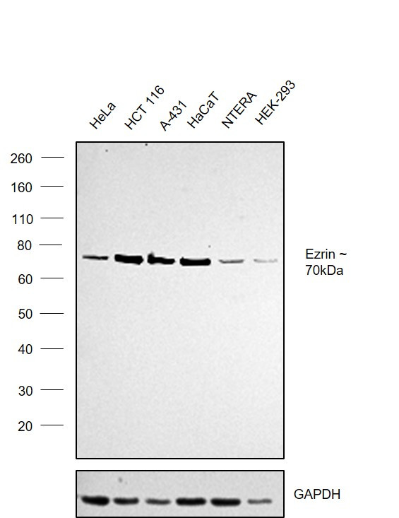 Ezrin Antibody