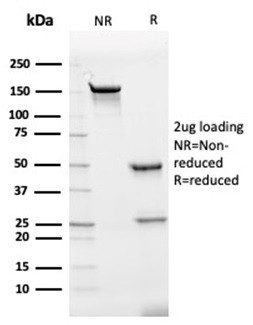 Interleukin-7 (IL-7) Antibody in SDS-PAGE (SDS-PAGE)