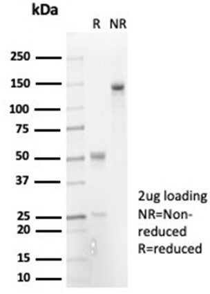 Interleukin-7 (IL-7) Antibody in SDS-PAGE (SDS-PAGE)