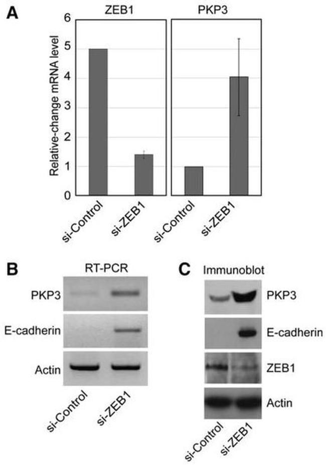 PKP3 Antibody in Western Blot, ChIP Assay (WB, ChIP)