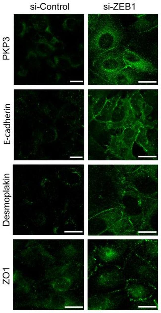 PKP3 Antibody in Immunocytochemistry (ICC/IF)