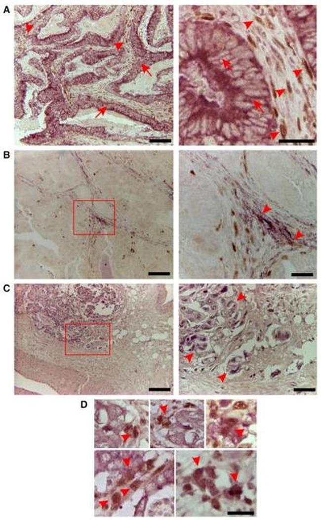 PKP3 Antibody in Immunohistochemistry (IHC)