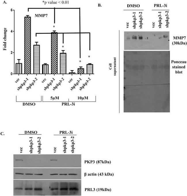 PKP3 Antibody in Western Blot (WB)