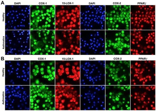 COX2 Antibody in Immunocytochemistry (ICC/IF)