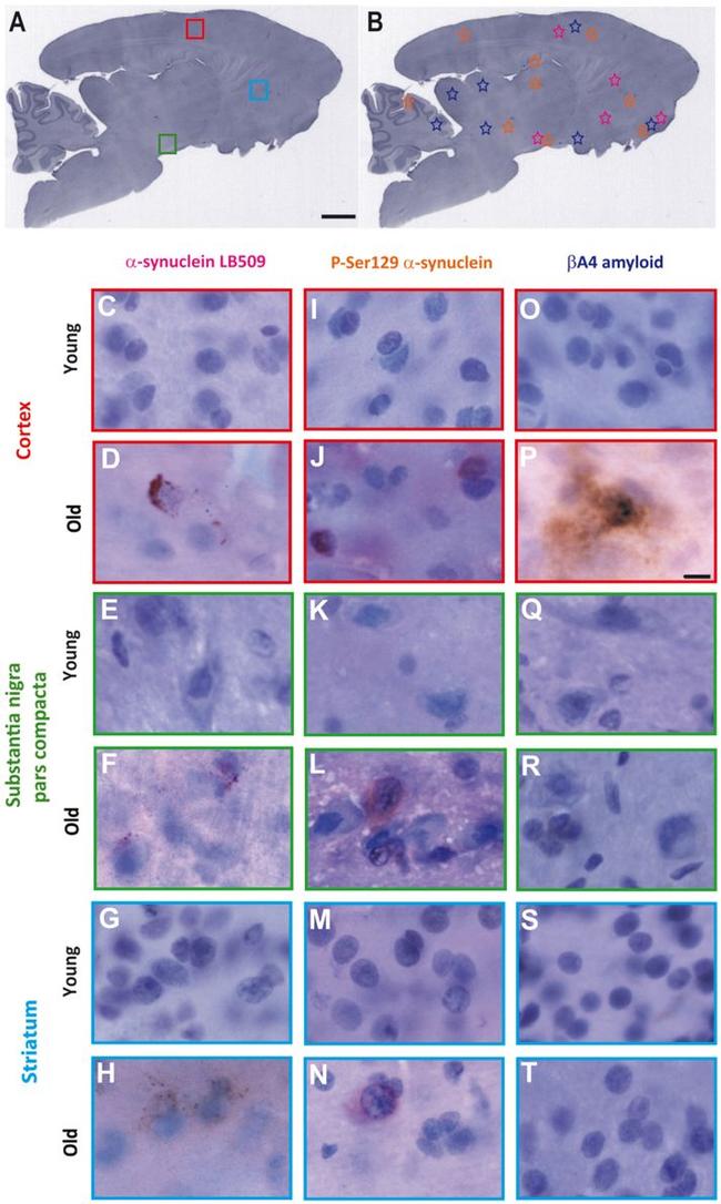 alpha Synuclein Antibody in Immunohistochemistry (IHC)