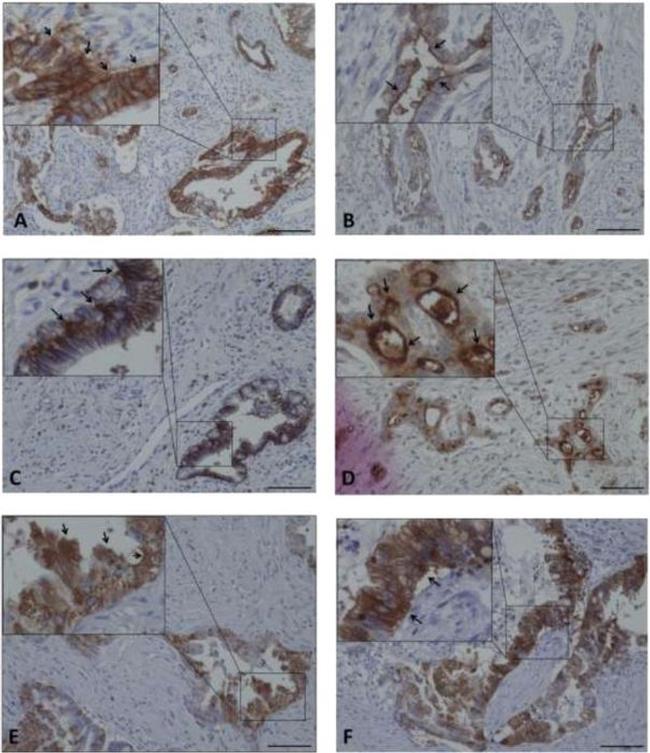 CXCR4 Antibody in Immunohistochemistry (Paraffin) (IHC (P))