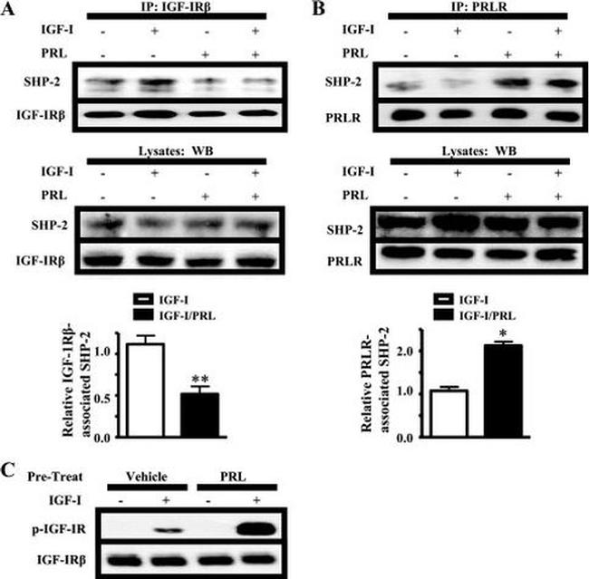 Prolactin Receptor Antibody in Western Blot, Immunoprecipitation (WB, IP)