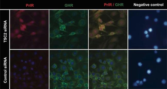 Prolactin Receptor Antibody in Immunocytochemistry (ICC/IF)