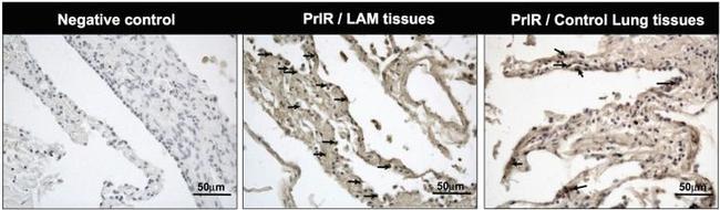 Prolactin Receptor Antibody in Immunohistochemistry (IHC)